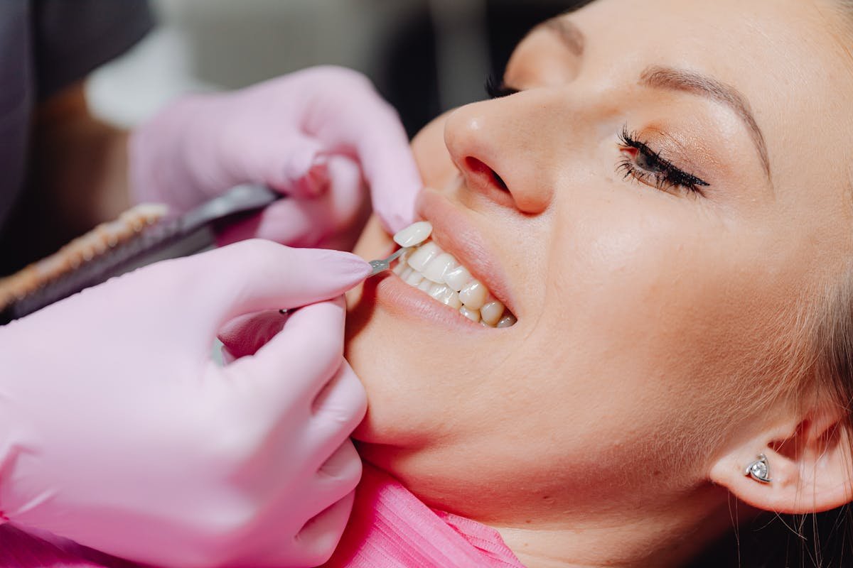 Custom smile veneers Miami
